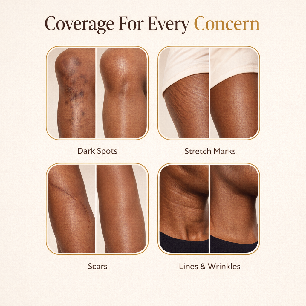 Skin-Match Body Coverage Cream